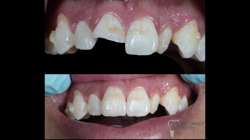 ‎Cases for website1.‎035
