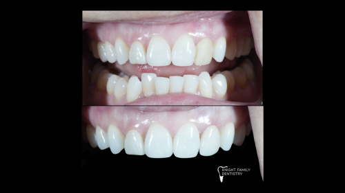 ‎Cases for website1.‎037