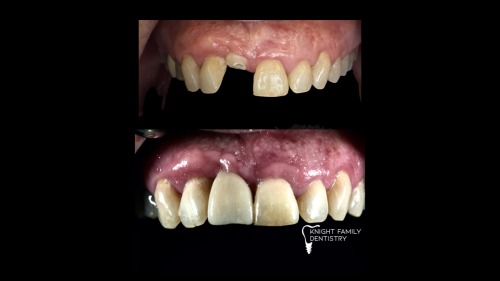 ‎Cases for website1.‎038