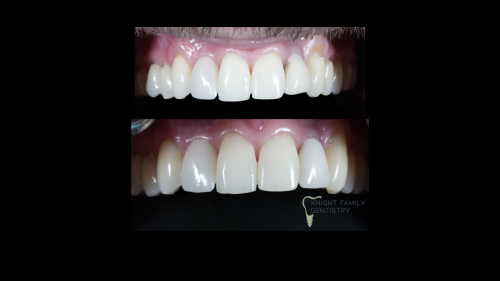 ‎Cases for website1.‎039