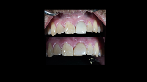 ‎Cases for website1.‎040