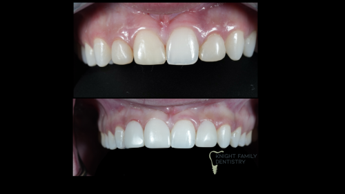 ‎Cases for website1.‎042