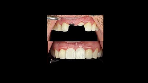 ‎Cases for website1.‎043